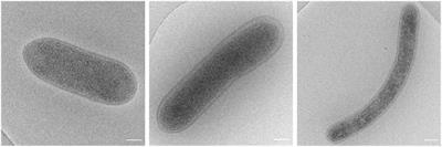 Frontiers | “Candidatus Hydrogenisulfobacillus filiaventi” strain